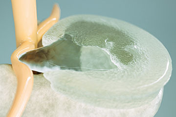 Description of Image
