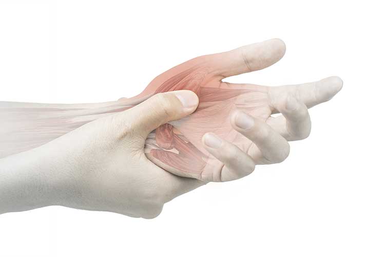 De Quervain's Tenosynovitis